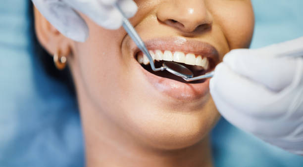Best Emergency Denture Repair in Maria Stein, OH